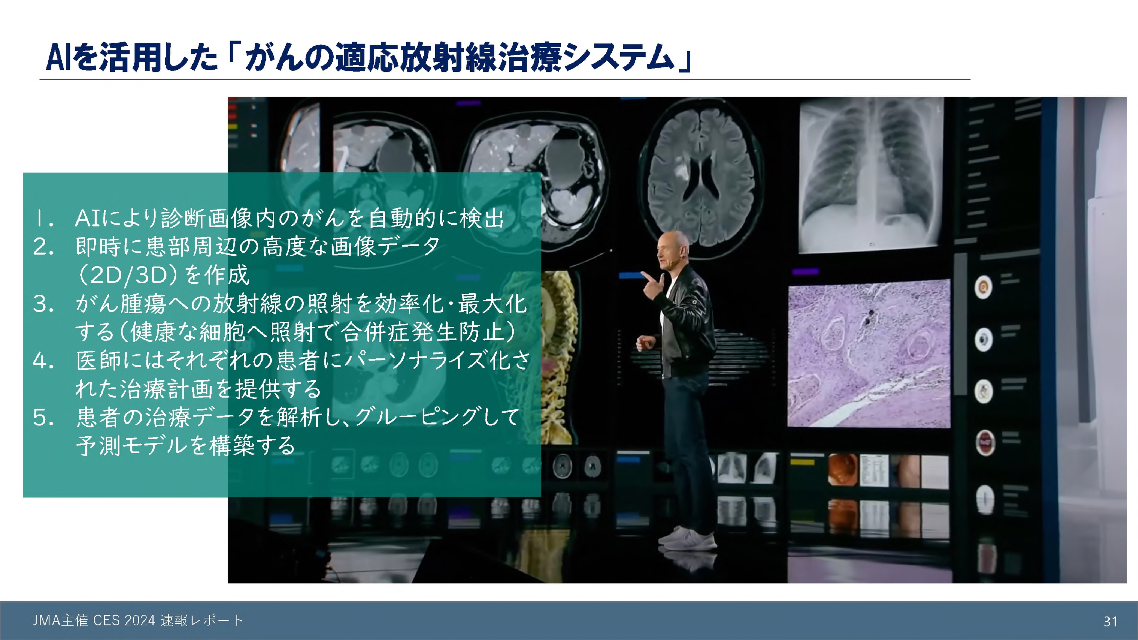 AIを活用した「がんの適応放射線治療システム」